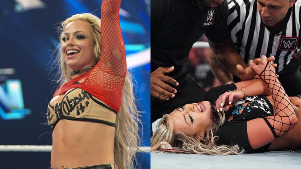 Liv Morgan Shares Graphic Injury Photos Ahead Of Championship Match