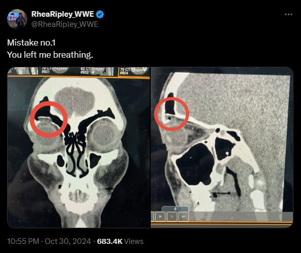 Rhea Ripley Breaks Silence On Injury After WWE Parking Lot Attack ...
