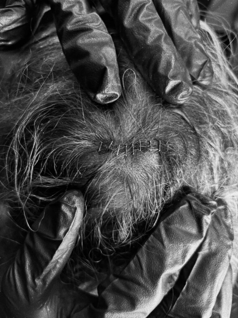 Sol Ruca's Instagram image of staples in her head following WWE NXT match