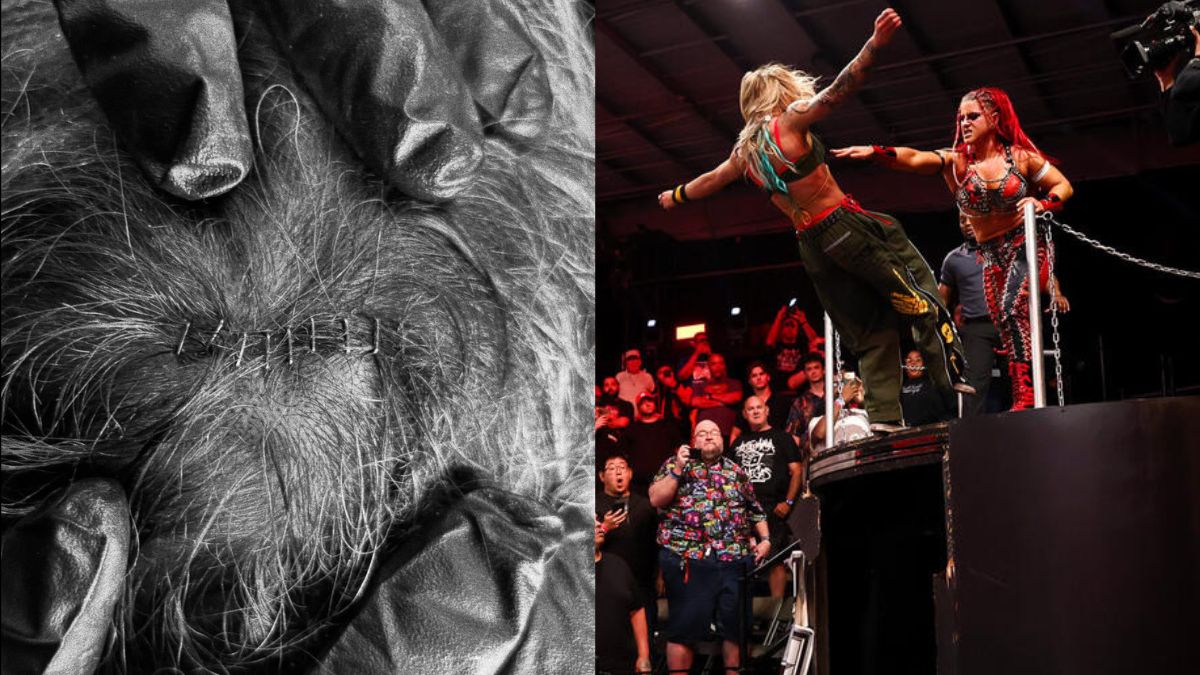 Sol Ruca Received Eight Staples After WWE NXT Last Woman Standing Match With Zaria