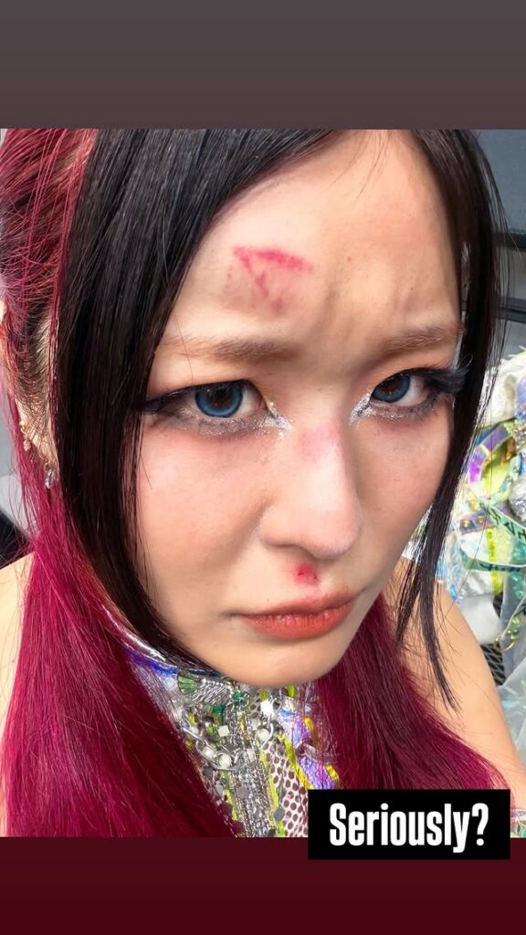 WWE Star Reveals Injury After Raw Match & Attack